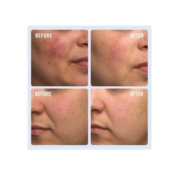 Ulta Repair Cream - Picture 7 of 10